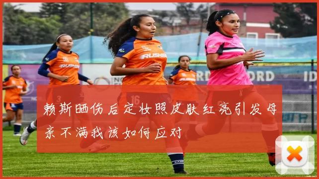 赖斯晒伤后定妆照皮肤红亮引发母亲不满我该如何应对